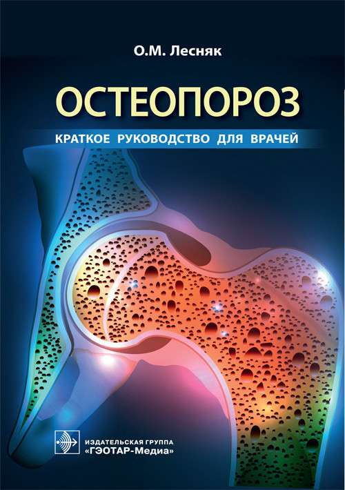 Остеопороз.Краткое руководство для врачей