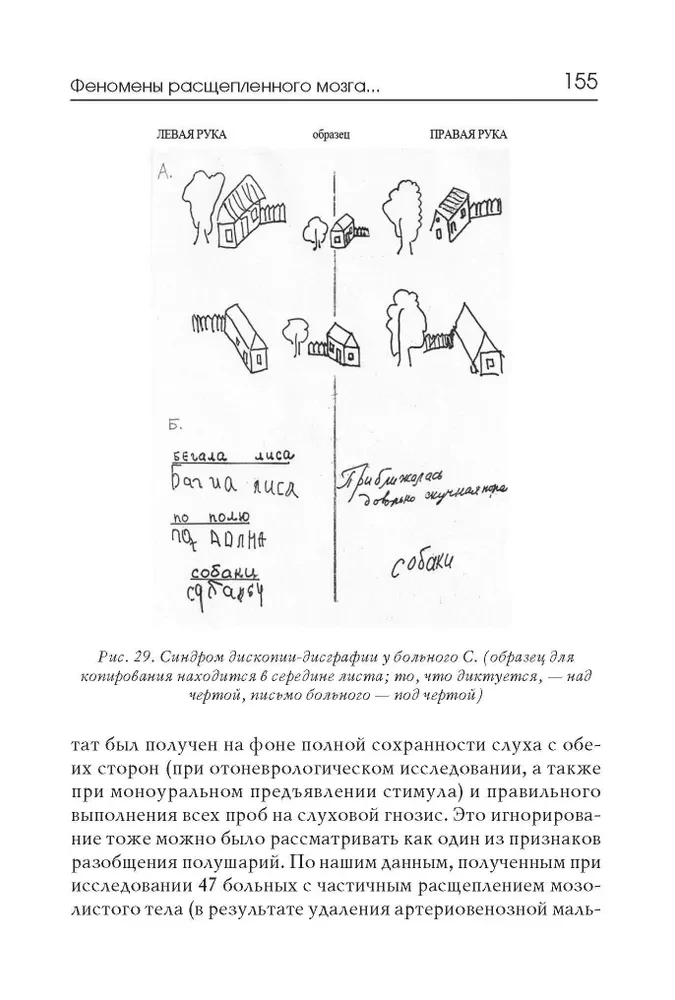 Neuropsychologische Syndrome bei Störungen der Gehirndurchblutung