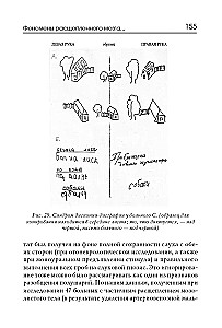 Neuropsychologische Syndrome bei Störungen der Gehirndurchblutung